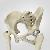 Mako Robotic Joint Replacement - Cahill Orthopedic Sports Medicine and  Joint Replacement